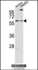 Anti-CRY2 Rabbit Polyclonal Antibody (FITC (Fluorescein))