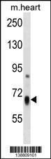 Anti-HBS1L Rabbit Polyclonal Antibody (HRP (Horseradish Peroxidase))