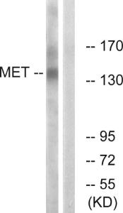 Western blot analysis of lysates from HepG2 cells using Anti-Met Antibody. The right hand lane represents a negative control, where the antibody is blocked by the immunising peptide.