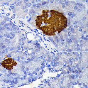 Immunohistochemistry analysis of paraffin-embedded rat pancreatic islet using Anti-SCGN / Secretagogin Antibody [ARC2196] (A306306) at a dilution of 1:100 (40x lens)