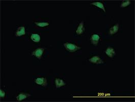 Anti-CNOT3 Mouse Monoclonal Antibody [clone: 4B8]