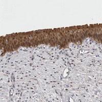 Anti-CHIC2 Rabbit Polyclonal Antibody