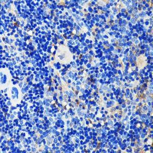 Immunohistochemistry analysis of paraffin-embedded mouse spleen using Anti-GRB2 Antibody [ARC0430] (A309206) at a dilution of 1:100 (40x lens). Perform microwave antigen retrieval with 10 mM PBS buffer pH 7.2 before commencing with IHC staining protocol