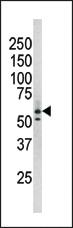 Anti-RAD9A Rabbit Polyclonal Antibody