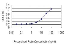 Anti-MUC4 Mouse Monoclonal Antibody [clone: 5B12]