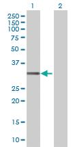 Anti-DKKL1 Mouse Polyclonal Antibody