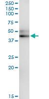 Anti-SERPINA12 Rabbit Polyclonal Antibody