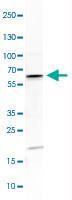 Anti-AKT3 Rabbit Polyclonal Antibody