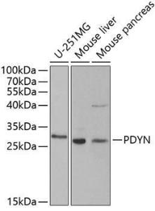 Western blot analysis of extracts of various cell lines, using Anti-ProDynorphin Antibody (A9754) at 1:1000 dilution