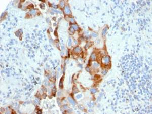 Anti-PMEPA1 Mouse Monoclonal Antibody [clone: PMEPA1/2696]