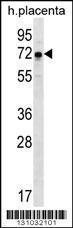 Anti-GNE Rabbit Polyclonal Antibody (FITC (Fluorescein Isothiocyanate))