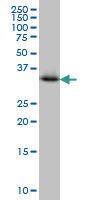 Anti-CRYM Mouse monoclonal antibody [clone: 6B3]