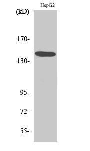 Western blot analysis of various cells using Anti-Met Antibody