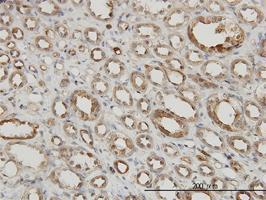 Anti-MAPKAPK2 Mouse Monoclonal Antibody [clone: 2B3]