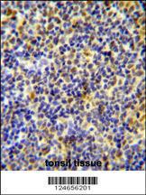 Anti-IKZF1 Rabbit Polyclonal Antibody (Biotin)