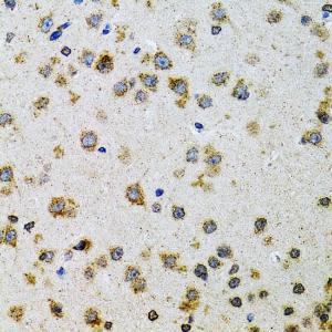 Immunohistochemistry analysis of paraffin-embedded rat brain using Anti-ProDynorphin Antibody (A9754) at a dilution of 1:100 (40x lens). Perform microwave antigen retrieval with 10 mM PBS buffer pH 7.2 before commencing with IHC staining protocol