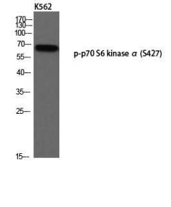 Western blot analysis of K562 using Anti-p70 S6 Kinase (phospho Ser427) Antibody