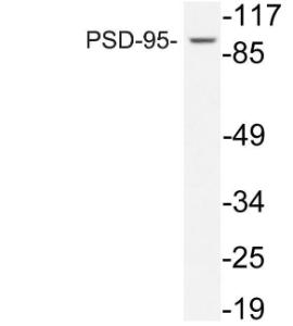 Western blot analysis of lysate from COLO205 cells using Anti-PSD-95 Antibody