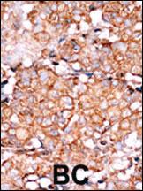 Anti-RAD9A Rabbit Polyclonal Antibody