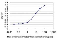 Anti-XPC Mouse Monoclonal Antibody [clone: 6D11]