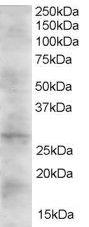 Anti-DKK2 Antibody (A83724) (2µg/ml) staining of Human Heart lysate (35µg protein in RIPA buffer). Primary incubation was 1 hour. Detected by chemiluminescence.