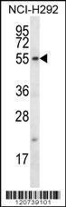 Anti-FBXO15 Rabbit Polyclonal Antibody (HRP (Horseradish Peroxidase))