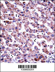 Anti-GDI2 Rabbit Polyclonal Antibody