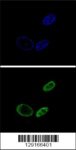 Anti-NR0B2 Rabbit Polyclonal Antibody (HRP (Horseradish Peroxidase))