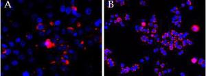 Anti-CEP290 Antibody (A83725) (2.5 µg/ml overnight staining of cell lines OPCT-1 (A) and MDA468 (fB) with Alexa Fluor 568 (red) and nuclear counter staining with DAPI (blue)