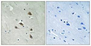 Immunohistochemical analysis of paraffin-embedded human brain using Anti-p70 S6 Kinase (phospho Ser427) Antibody 1:100 (4 °C overnight). The right hand panel represents a negative control, where the antibody was pre-incubated with the immunising peptide