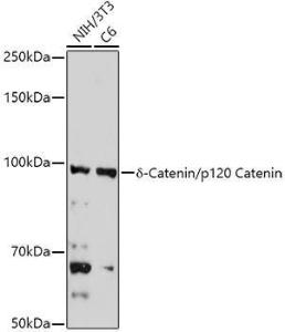 Western blot analysis of extracts of various cell lines, using Anti-delta 1 Catenin / CAS Antibody (A306307) at 1:1,000 dilution. The secondary antibody was Goat Anti-Rabbit IgG H&L Antibody (HRP) at 1:10,000 dilution.