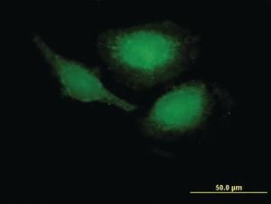 Anti-PHLDA1 Mouse Polyclonal Antibody