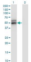 Anti-SERPINA12 Mouse Monoclonal Antibody [clone: 3B3]