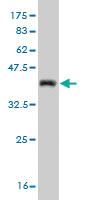 Anti-CDK4 Mouse Monoclonal Antibody [clone: 2A1]