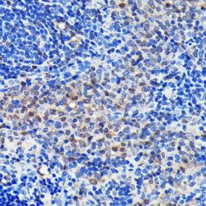 Immunohistochemistry analysis of paraffin-embedded rat spleen using Anti-GRB2 Antibody [ARC0430] (A309206) at a dilution of 1:100 (40x lens). Perform microwave antigen retrieval with 10 mM PBS buffer pH 7.2 before commencing with IHC staining protocol