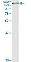 Anti-NUMA Antibody Pair