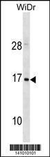 Anti-HBZ Rabbit Polyclonal Antibody