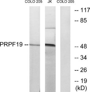 Western blot analysis of lysates from COLO and Jurkat cells using Anti-PRPF19 Antibody. The right hand lane represents a negative control, where the antibody is blocked by the immunising peptide