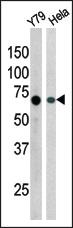 Anti-RAD9A Rabbit Polyclonal Antibody