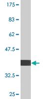 Anti-UBE4B Mouse Monoclonal Antibody [clone: 1D5]