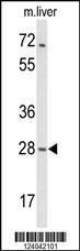 Anti-MOB2 Rabbit Polyclonal Antibody (AP (Alkaline Phosphatase))