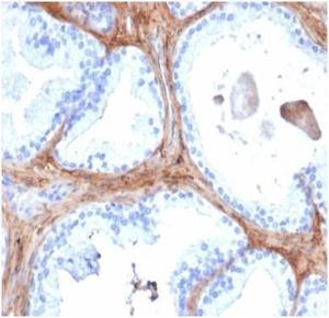 Immunohistochemical analysis of formalin-fixed, paraffin-embedded human prostate tissue using Anti-Decorin Antibody [DCN/6289]