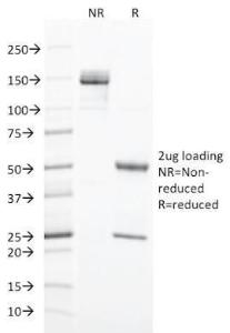 SDS-PAGE analysis of Anti-Cytokeratin 20 Antibody [KRT20/1993] under non-reduced and reduced conditions; showing intact IgG and intact heavy and light chains, respectively. SDS-PAGE analysis confirms the integrity and purity of the antibody