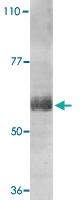 Anti-IL21R Rabbit Polyclonal Antibody