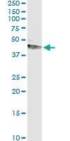 Anti-SERPINA12 Mouse Monoclonal Antibody [clone: 3B3]