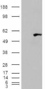 HEK293 overexpressing WIPF1 (RC217601) and probed with Anti-WIPF1 Antibody (A83726) (mock transfection in first lane), tested by Origene