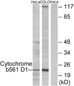 Anti-CYB561D1 Rabbit Polyclonal Antibody