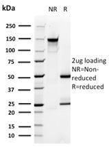 Anti-PMEPA1 Mouse Monoclonal Antibody [clone: PMEPA1/2696]