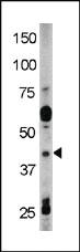 Anti-RAD9A Rabbit Polyclonal Antibody