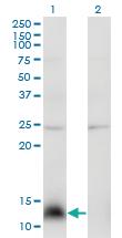 Anti-NPY Mouse Monoclonal Antibody [clone: 3B5]